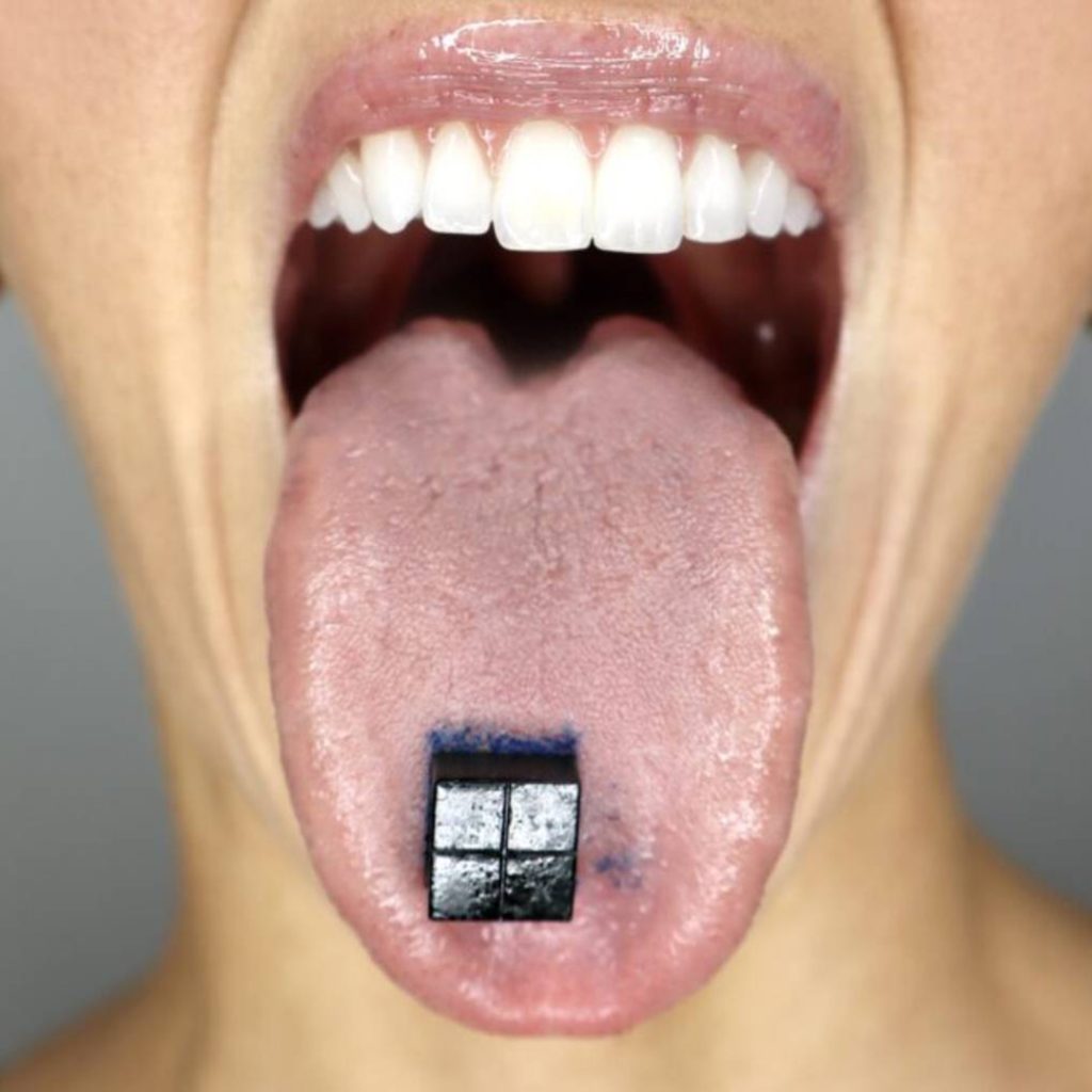 Lumetol Blue Bars on Tongue
